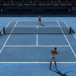 Tennis Elbow 4